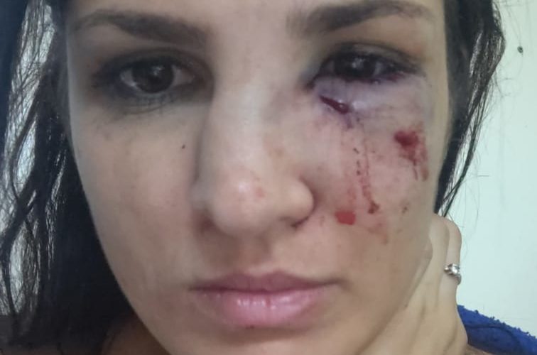 Vítima de agressão em cidade vizinha pede doações para cirurgia