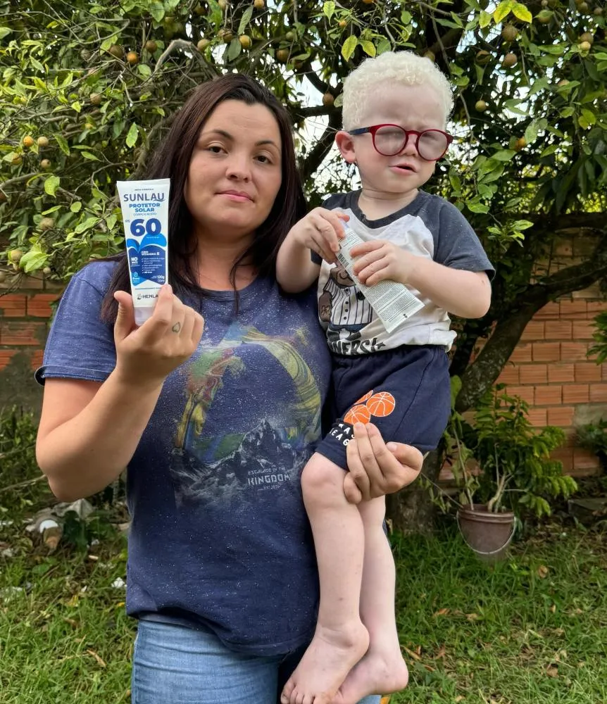 Léo sofre de albinismo, condição que deixa sua pele extremamente sensível ao raios solares. 