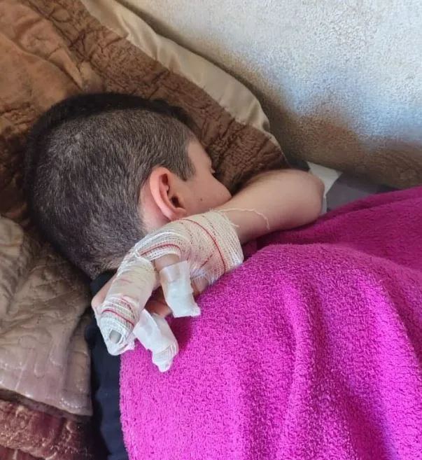 Pai acusa descaso na Escola Hatsue Toyota após filho sair com dedo fraturado e sem socorro imediato