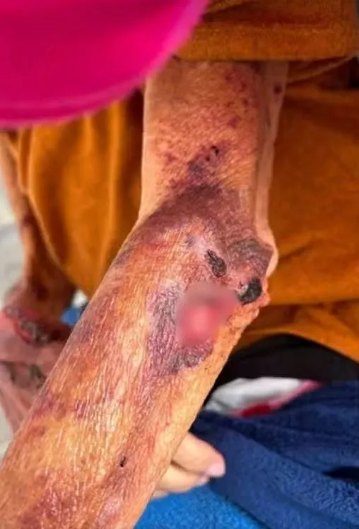 Filha é presa suspeita de agredir e manter mãe idosa desnutrida na região